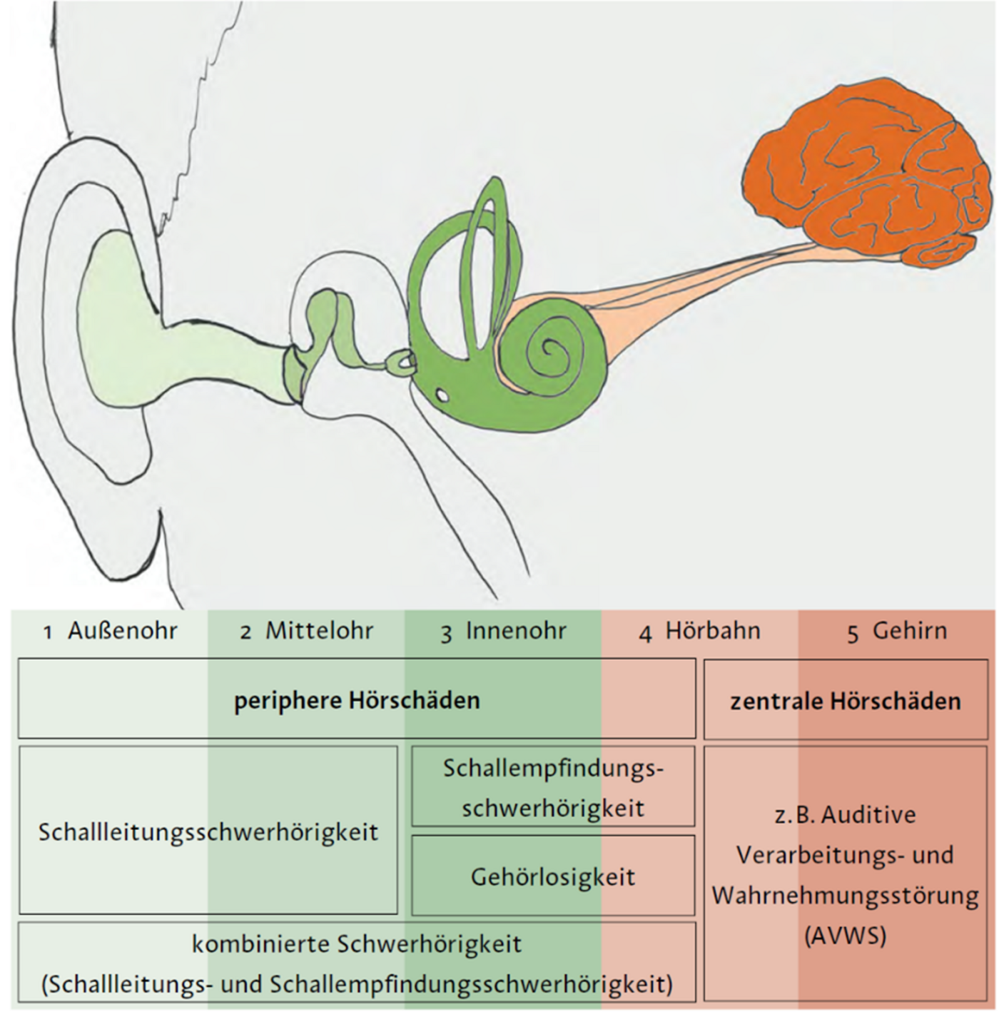 Rechtes Ohr und rechte Kopfseite sind als graue Fläche gezeichnet. In hellgrüner Farbe ist der innere Teil der Ohrmuschel und der Gehörgang abgebildet.